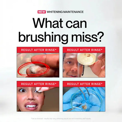 🦷Whitening mouthwash removes tooth stains, brightens your teeth