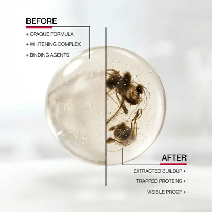 🦷Whitening mouthwash removes tooth stains, brightens your teeth