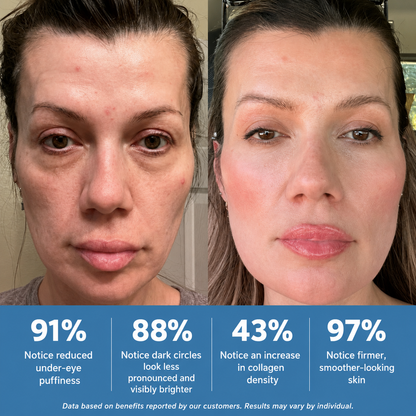 Eye Releaf👓 Under Eye Therapy Glasses for Puffy Eyes, Eye Bags & Dark Circles – Eye Fatigue Relief
